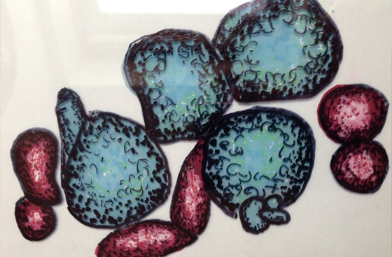 Parents drawing of Acute Lymphoblastic Leukaemia Cells on perspex